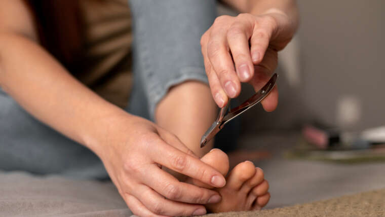 Choroby paznokci – jak je rozpoznać i kiedy zgłosić się do dermatologa?