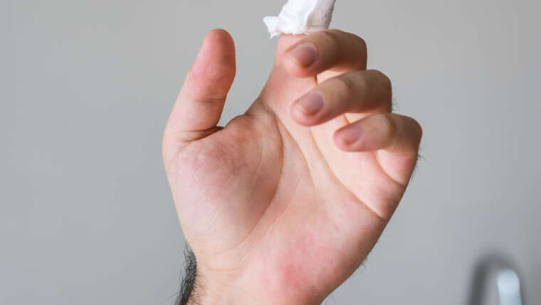 Zastrzał – czym jest, jak powstaje i jak go leczyć?