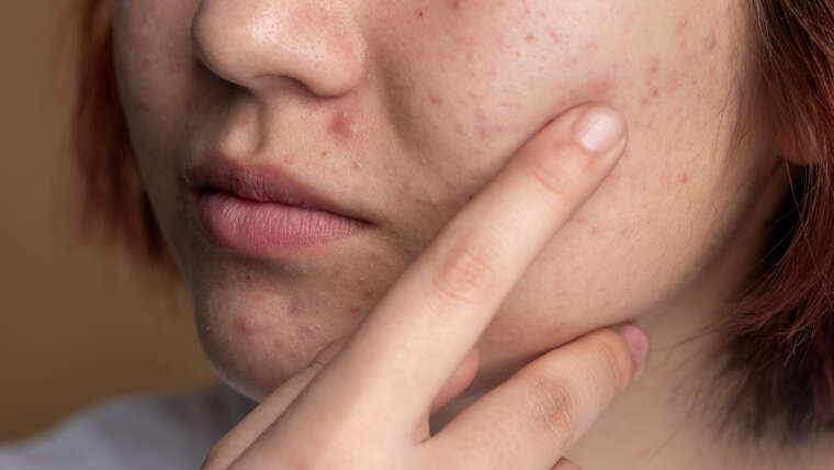 Dermatologiczne choroby skóry