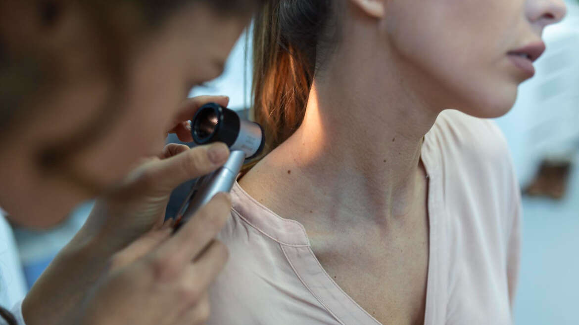 Kiedy pieprzyk staje się zagrożeniem? Dlaczego warto robić diagnostykę znamion
